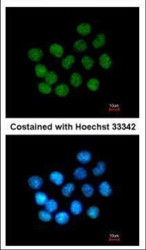 SAFB2 Antibody in Immunocytochemistry (ICC/IF)
