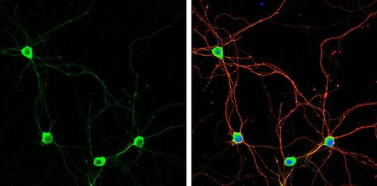 PUM1 Antibody in Immunocytochemistry (ICC/IF)