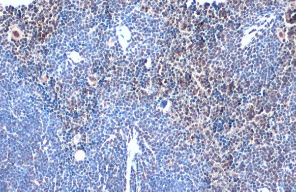 TOX Antibody in Immunohistochemistry (Paraffin) (IHC (P))