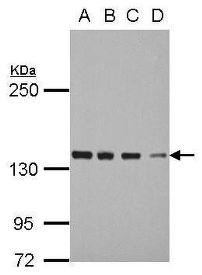 DDX46 Antibody in Western Blot (WB)