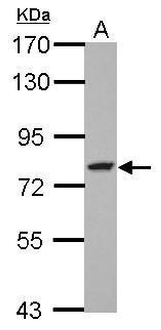 GFPT2 Antibody in Western Blot (WB)