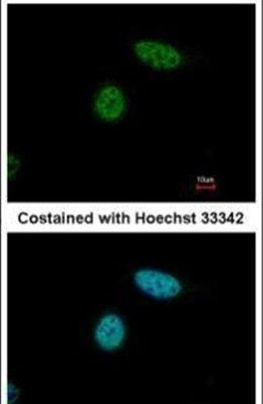 USP3 Antibody in Immunocytochemistry (ICC/IF)