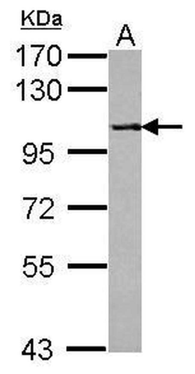 PPP4R1 Antibody in Western Blot (WB)