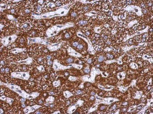 TOM1L1 Antibody in Immunohistochemistry (Paraffin) (IHC (P))
