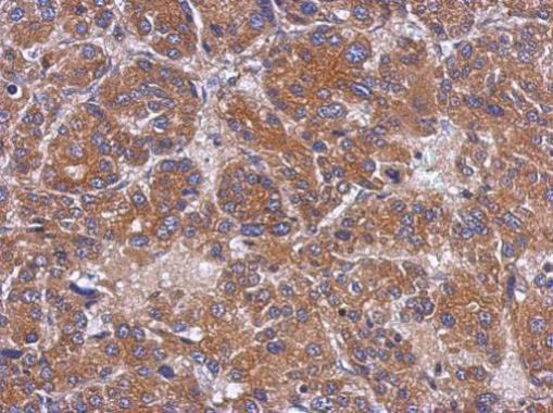 TOM1L1 Antibody in Immunohistochemistry (Paraffin) (IHC (P))