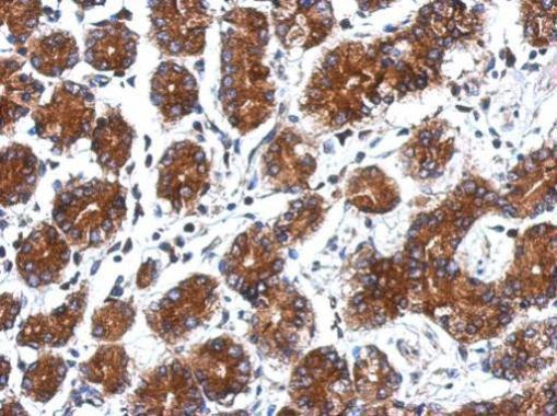 ARPC5 Antibody in Immunohistochemistry (Paraffin) (IHC (P))