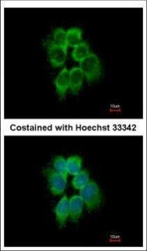 p41-ARCb Antibody in Immunocytochemistry (ICC/IF)