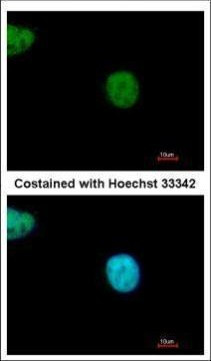 YAF2 Antibody in Immunocytochemistry (ICC/IF)