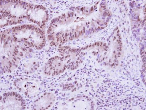 Vinexin Antibody in Immunohistochemistry (Paraffin) (IHC (P))