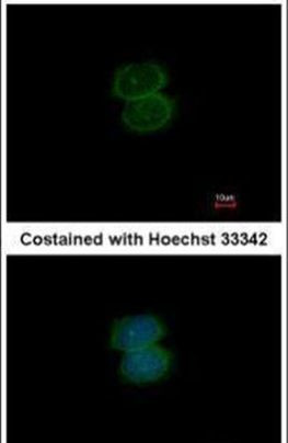 PRMT3 Antibody in Immunocytochemistry (ICC/IF)