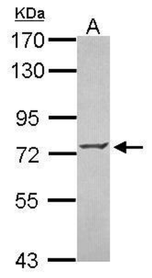 ZNF443 Antibody in Western Blot (WB)