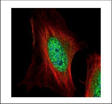 EMP Antibody in Immunocytochemistry (ICC/IF)