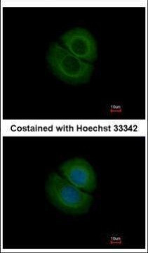 Coronin 2B Antibody in Immunocytochemistry (ICC/IF)