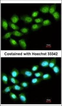 PRMT5 Antibody in Immunocytochemistry (ICC/IF)