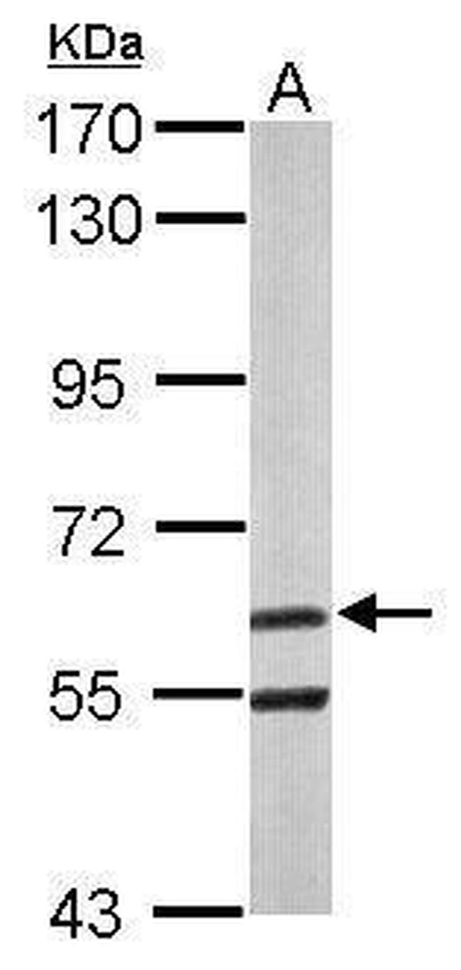 ARIH2 Antibody in Western Blot (WB)