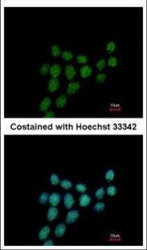 PIBF1 Antibody in Immunocytochemistry (ICC/IF)