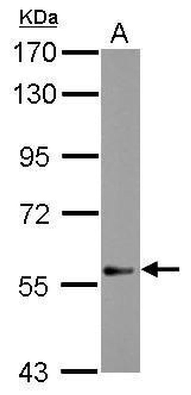 DEAF1 Antibody in Western Blot (WB)