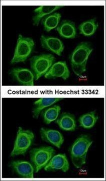 Dynactin 2 Antibody in Immunocytochemistry (ICC/IF)
