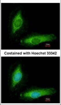SCGN Antibody in Immunocytochemistry (ICC/IF)