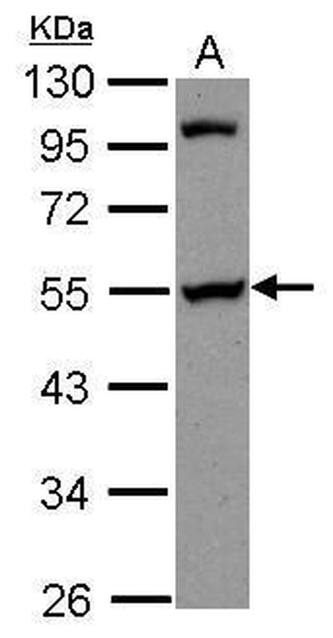 PAIP1 Antibody in Western Blot (WB)