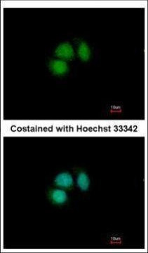 CUG-BP2 Antibody in Immunocytochemistry (ICC/IF)