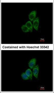 TCP-1 theta Antibody in Immunocytochemistry (ICC/IF)