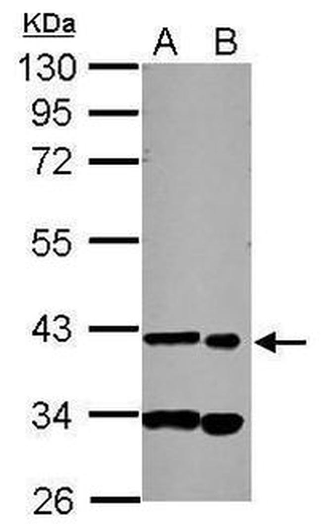 SDCCAG8 Antibody in Western Blot (WB)