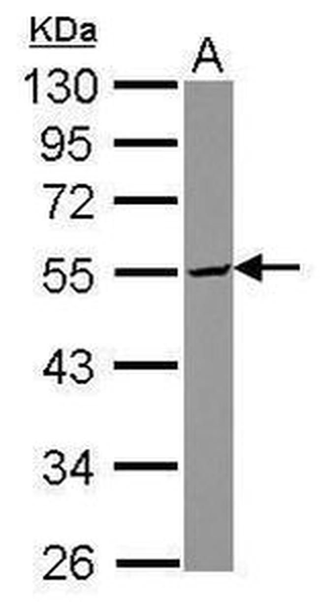 TDE1 Antibody in Western Blot (WB)