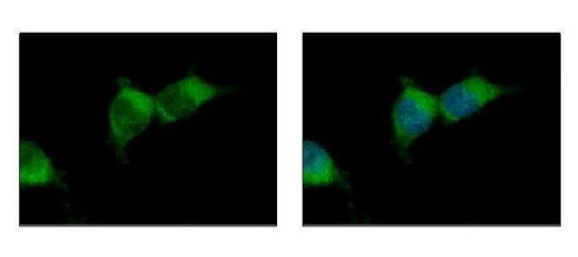 VIP36 Antibody in Immunocytochemistry (ICC/IF)