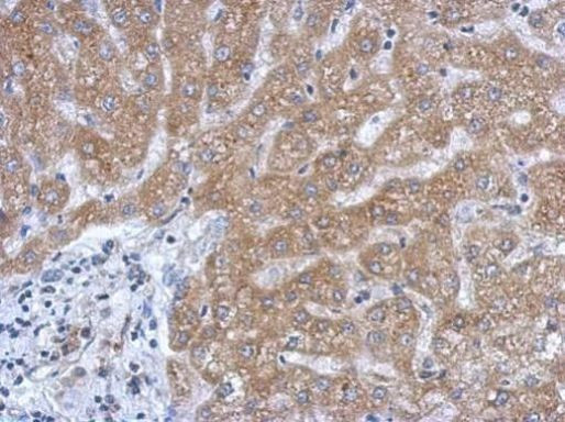 SLC27A2 Antibody in Immunohistochemistry (Paraffin) (IHC (P))