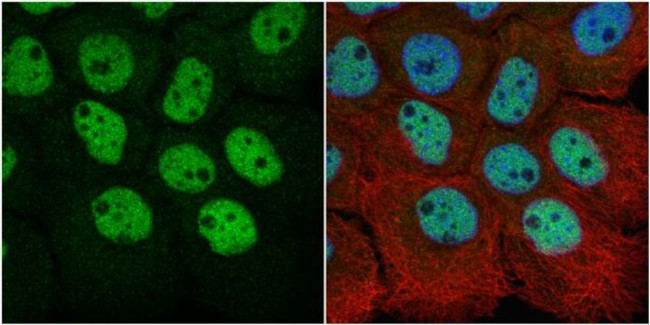 RbAp48 Antibody in Immunocytochemistry (ICC/IF)