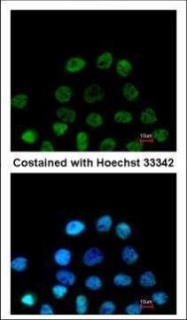 RbAp48 Antibody in Immunocytochemistry (ICC/IF)