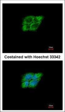 NAA15 Antibody in Immunocytochemistry (ICC/IF)
