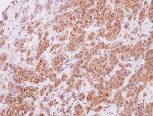 STYXL1 Antibody in Immunohistochemistry (Paraffin) (IHC (P))
