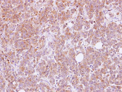 ANKHD1 Antibody in Immunohistochemistry (Paraffin) (IHC (P))