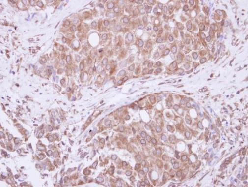 ATE1 Antibody in Immunohistochemistry (Paraffin) (IHC (P))