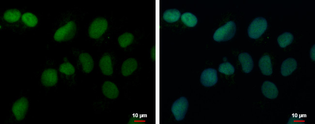 PRDM4 Antibody in Immunocytochemistry (ICC/IF)