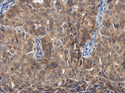 FGFR1OP Antibody in Immunohistochemistry (Paraffin) (IHC (P))