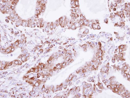 LDB3 Antibody in Immunohistochemistry (Paraffin) (IHC (P))