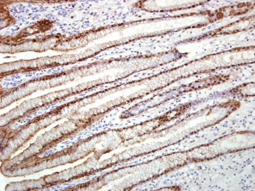 Annexin A10 Antibody in Immunohistochemistry (Paraffin) (IHC (P))