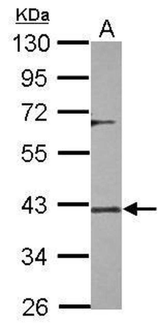 DUSP12 Antibody in Western Blot (WB)