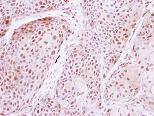 DDX19B Antibody in Immunohistochemistry (Paraffin) (IHC (P))