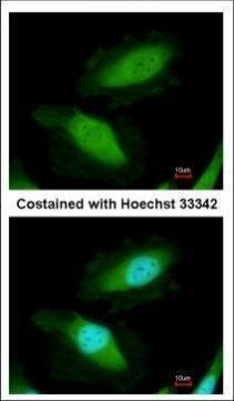 DDX19B Antibody in Immunocytochemistry (ICC/IF)