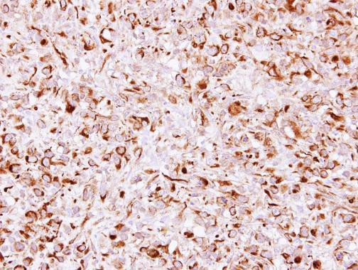 CHSY1 Antibody in Immunohistochemistry (Paraffin) (IHC (P))