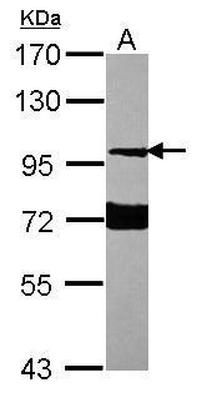 Neuroligin 1 Antibody in Western Blot (WB)