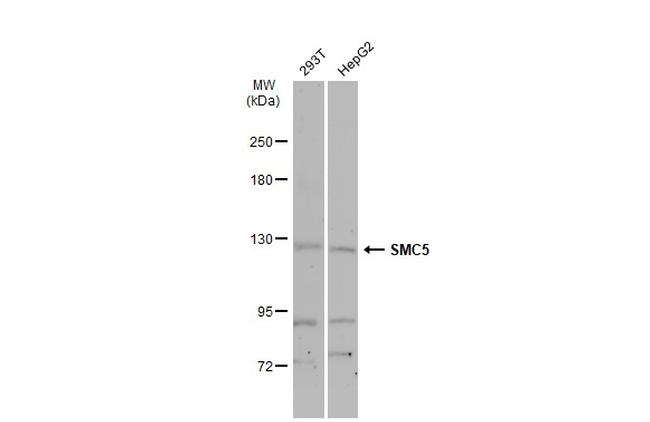 SMC5 Antibody in Western Blot (WB)