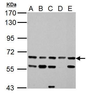 ACSL6 Antibody in Western Blot (WB)