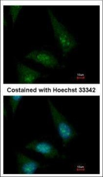 CLASP1 Antibody in Immunocytochemistry (ICC/IF)