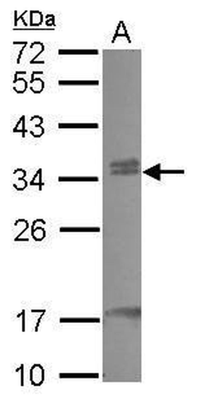 CBX7 Antibody in Western Blot (WB)