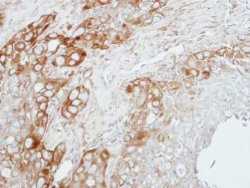 ZNF346 Antibody in Immunohistochemistry (Paraffin) (IHC (P))